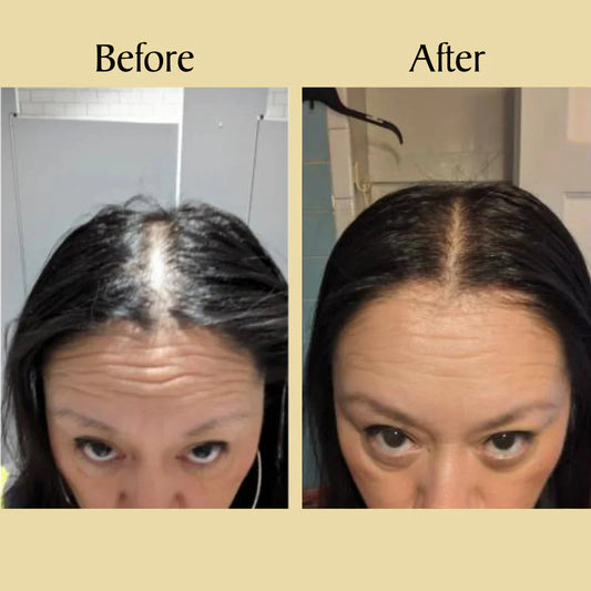 Batana Hair Growth Oil (75% OFF TODAY)