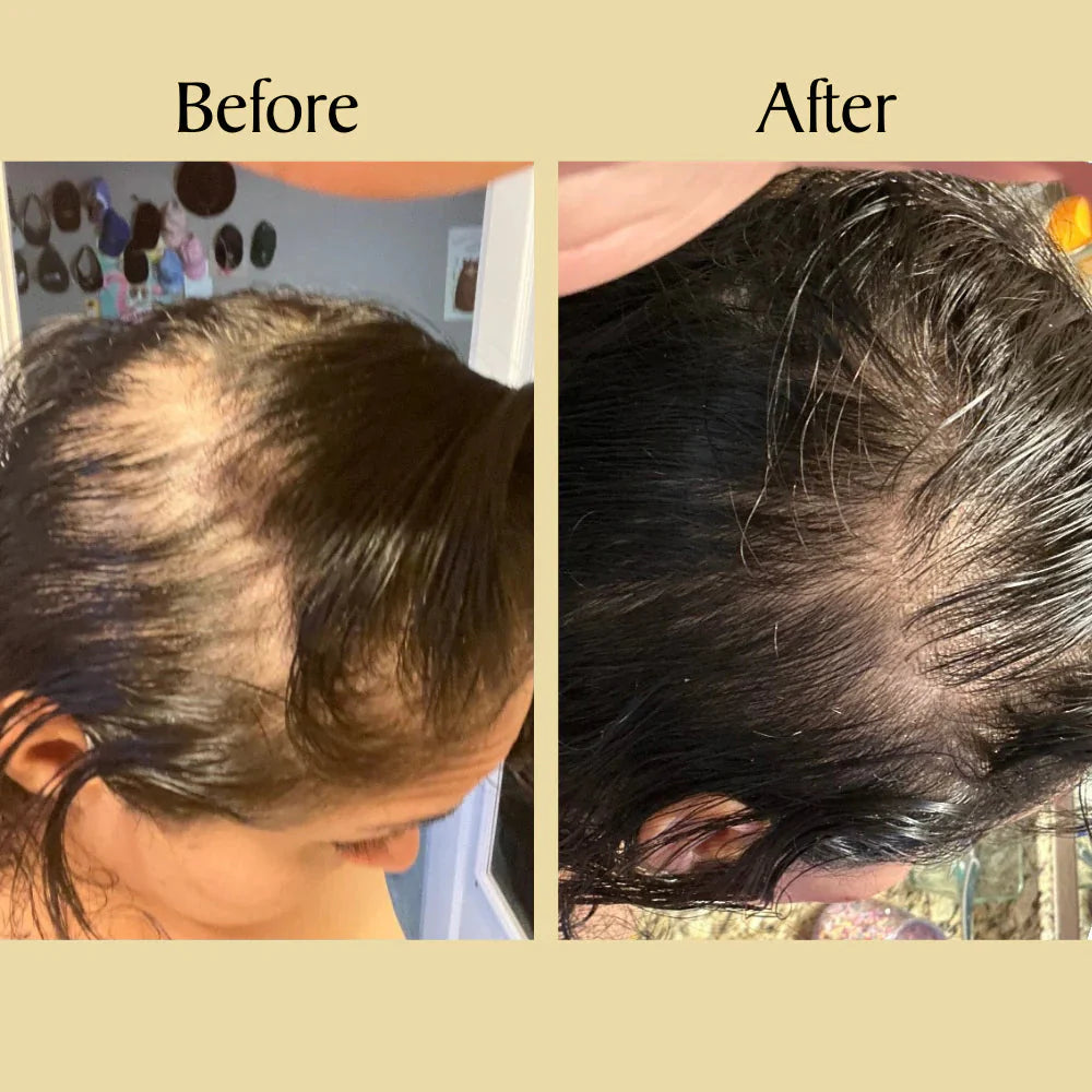 Batana Hair Growth Oil (75% OFF TODAY)