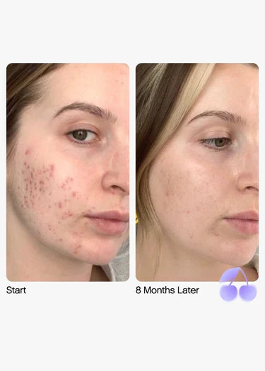 Faded Dark Spot Serum